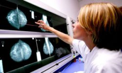 BMJ: Screening-ul cancerului nu salvează vieți