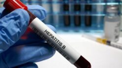 Aproximativ 5. 500 de decese cauzate de hepatită în UE