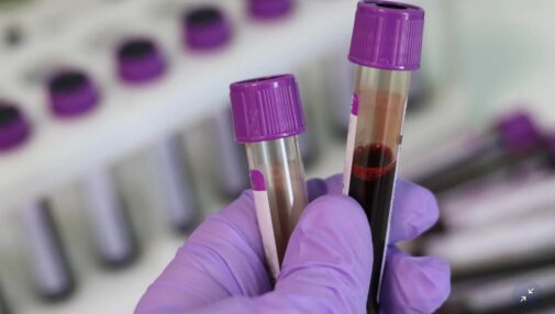 Noi norme UE privind utilizarea sângelui, țesuturilor și a altor substanțe de origine umană